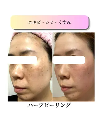 ローズフィールド 森岡朋美のエステ・リラクイメージ