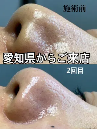 小林 菜月のエステ・リラクイメージ
