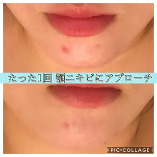 セミロング カラー パーマ ヘアアレンジ キッズ ネイル マツエク・マツパ EnsorClair 代表 野口真央のエステ・リラクイメージ