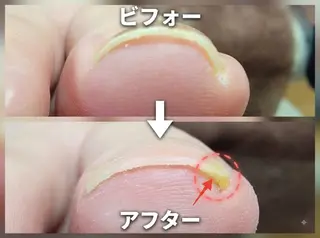 ネイル&巻き爪サロン AKnailのネイルデザイン