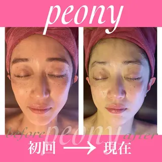 デトックス美容専門 サロンpeonyのエステ・リラクイメージ