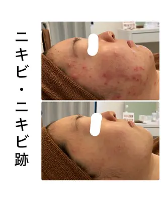 ハーブピーリング専門 BIOPLUS+川崎のエステ・リラクイメージ