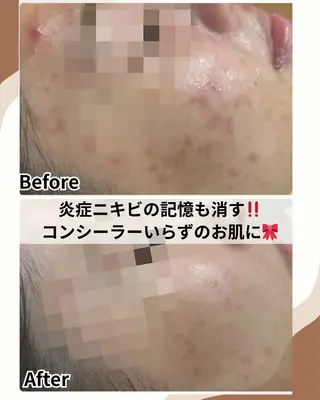 美肌脱毛サロン muroのエステ・リラクイメージ