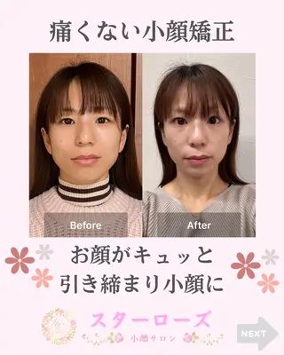 小顔矯正サロン スターローズのエステ・リラクイメージ