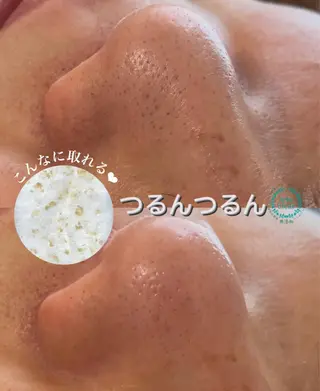 毛穴/シミ肝斑/脱毛 横山梨里のエステ・リラクイメージ