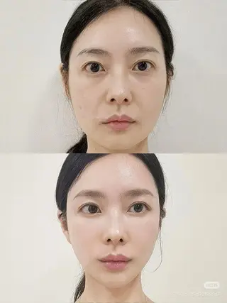 ネイル 愛維美水光専門店 川崎彩鳳のエステ・リラクイメージ