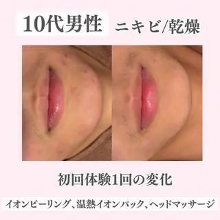 ニキビ・肌質改善専門 ♡人生が変わるサロンのエステ・リラクイメージ