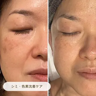 CURATED SKIN|神戸三宮のエステ・リラクイメージ