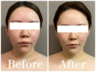 💎小顔サロン アリリン銀座💎のエステ・リラクイメージ