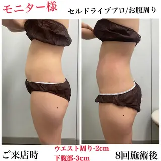 エステサロン Venusのその他イメージ