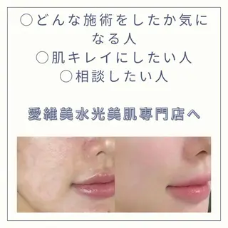 愛維美水光美肌専門店 メンズレディースokのエステ・リラクイメージ