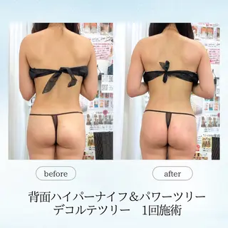 《痩身、小顔専門店》 エスプレッソのエステ・リラクイメージ