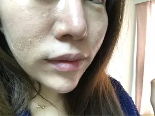 ハーブピーリング専門 店⭐︎AI.HERBのエステ・リラクイメージ
