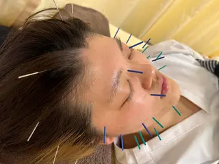 鍼灸サロン BBB3のその他イメージ