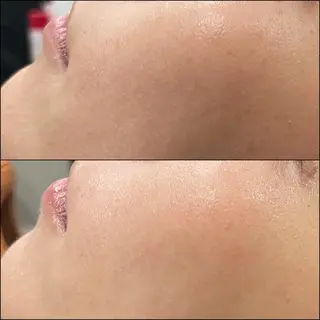 LiZA エステティックサロンのエステ・リラクイメージ