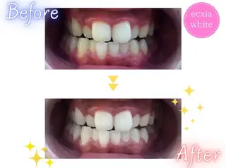 メンズ nene -ホワイトニングのその他イメージ