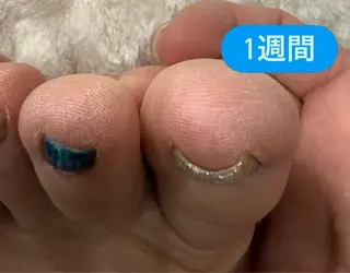 ネイル koko nailのネイルデザイン