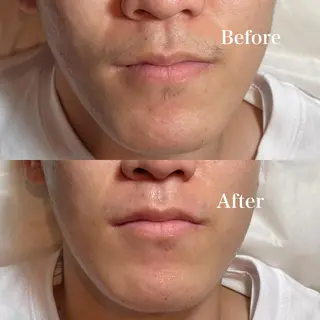 KKSbeauty 🎀心斎橋本店Hのマツエク・マツパデザイン
