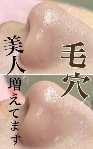 Balance facialのその他イメージ