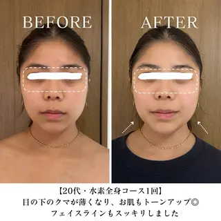 【三軒茶屋/下馬】 本格痩身・よもぎ蒸しのエステ・リラクイメージ