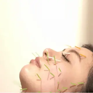 美容鍼 💎 鍼灸 ✨ 矢野先生 ✨のエステ・リラクイメージ