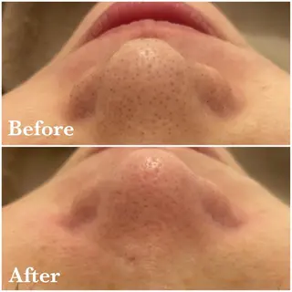 メゾンリュバン 天王寺店のエステ・リラクイメージ