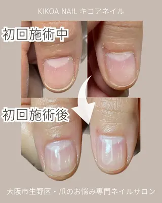 ネイル KIKOA NAIL キコアネイルのネイルデザイン