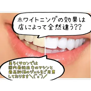 メンズ セルフホワイトニング メーカー直営サロンのエステ・リラクイメージ