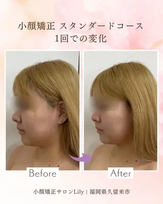 小顔矯正サロン Lilyのエステ・リラクイメージ