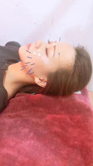 美容鍼灸女性専用 りんご鍼灸治療院のエステ・リラクイメージ