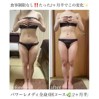《本気痩せ×疲労改善 》  BILOOPのエステ・リラクイメージ