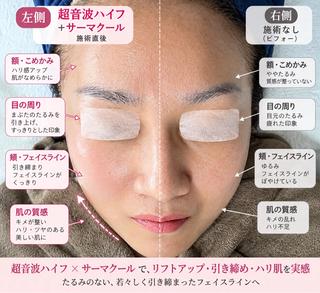 マツエク・マツパ 愛維美 肌質改善サロンのエステ・リラクイメージ
