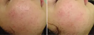 ミディアム カラー パーマ ヘアアレンジ メンズ キッズ ネイル マツエク・マツパ アニメ,Vオタク× 即効痩せエステサロンのエステ・リラクイメージ