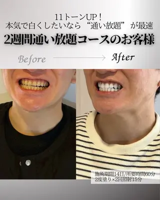 歯科提携エラン ホワイトニング一社店のその他イメージ