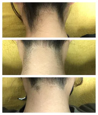 salon de epilaのエステ・リラクイメージ