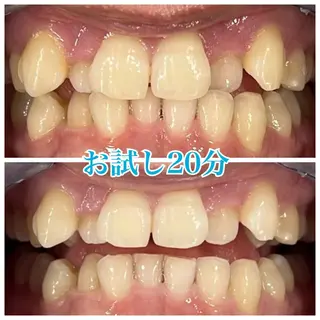 ホワイトニング🦷 ネイル💅LEAのその他イメージ