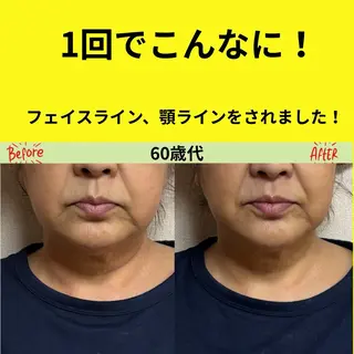 LUMINAルミナ 【肌管理サロン】のその他イメージ