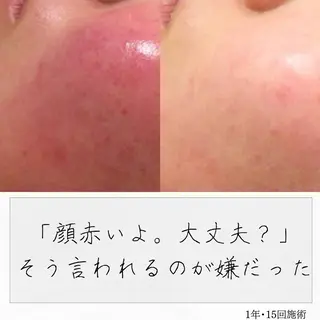 ニキビ経験者が施術 する専門サロン🌻のエステ・リラクイメージ