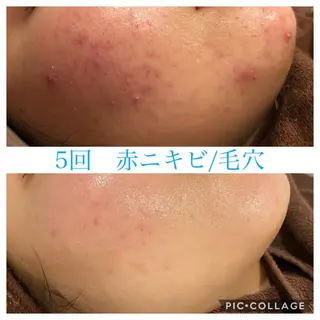 ショート カラー パーマ ヘアアレンジ メンズ ネイル マツエク・マツパ EnsorClair 代表 野口真央のエステ・リラクイメージ