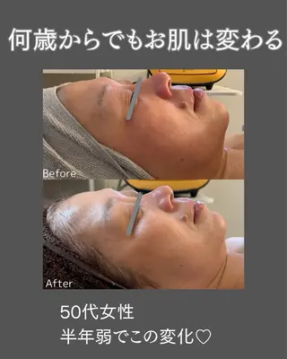 BLOSSOM 菊地のエステ・リラクイメージ