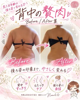 切らない脂肪吸引🔥 Neroliまりこのエステ・リラクイメージ