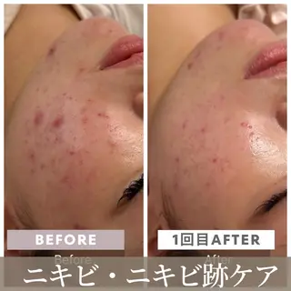 小顔矯正・美肌ケア 池田 桃花のエステ・リラクイメージ