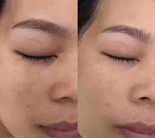 ネイル 愛維美水光専門店 川崎彩鳳のエステ・リラクイメージ