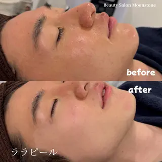 メンズ Moonstone 腸活ダイエット・脱毛のエステ・リラクイメージ