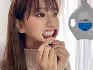 東区香椎歯のセルフホ ワイトニングGLOWのその他イメージ