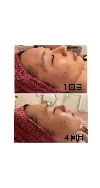 松下 千恵のネイルデザイン