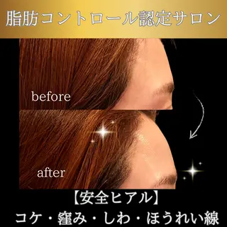 clinical salon enのエステ・リラクイメージ