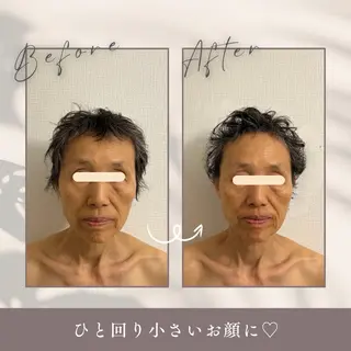 小顔セラピー LILのエステ・リラクイメージ