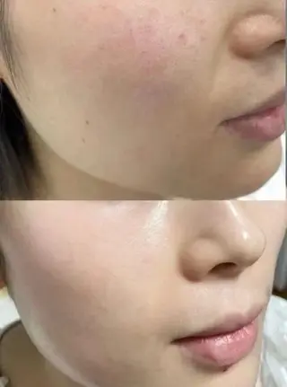 マツエク・マツパ 愛維美水光専門店 川崎彩鳳のエステ・リラクイメージ