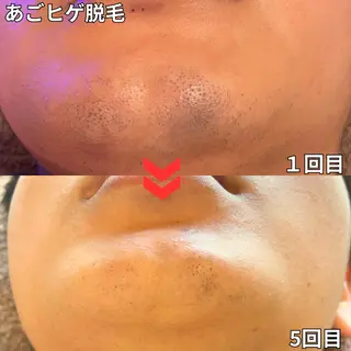 メンズ 都度払い制メンズ脱毛 オーナーのエステ・リラクイメージ